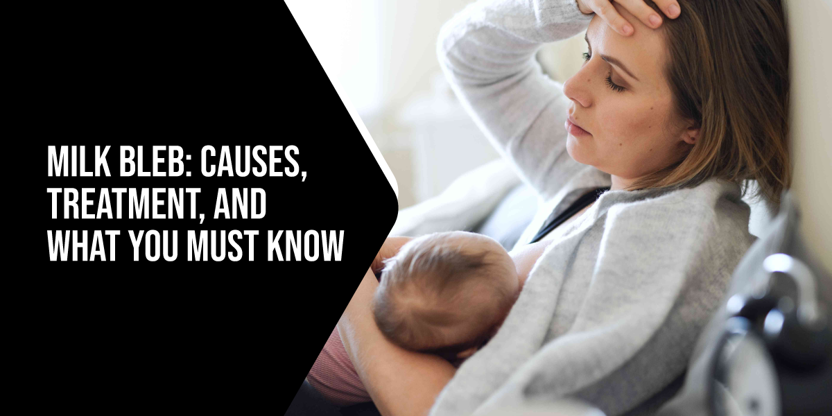 Milk Bleb: Causes, Treatment, and What You Must Know